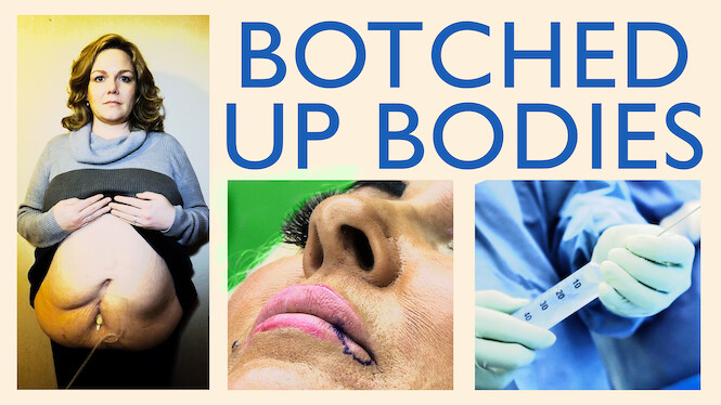 Botched Up Bodies 2013 Netflix Flixable